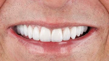 Paradise Dental Dubai gallery photo 10