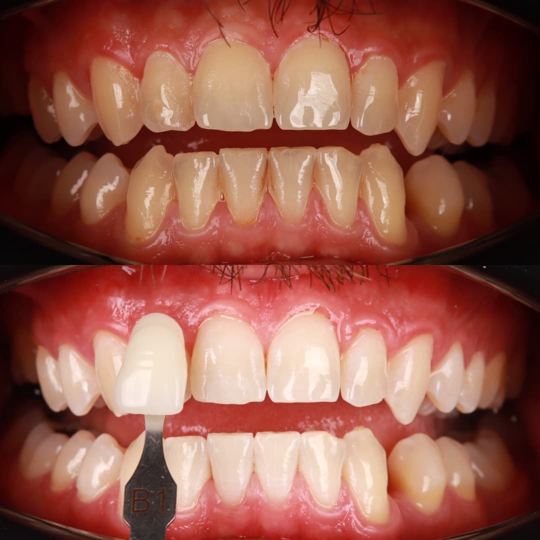 Paradise Dental Dubai gallery photo 14