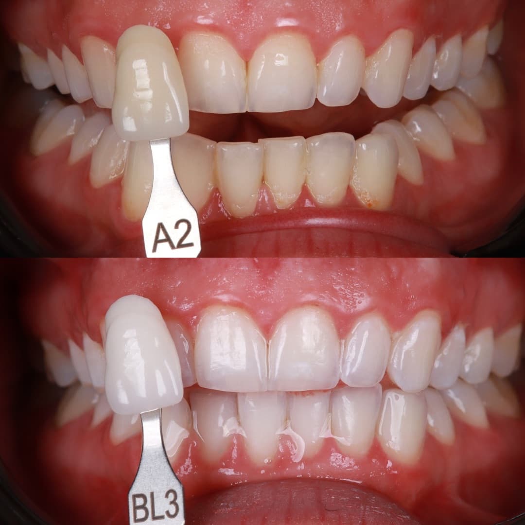 Paradise Dental Dubai gallery photo 15