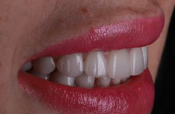Paradise Dental Dubai gallery photo 3