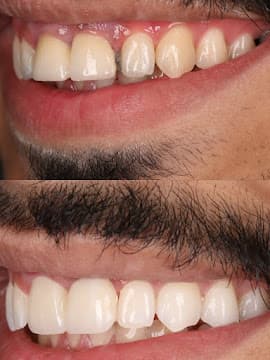 Paradise Dental Dubai gallery photo 5