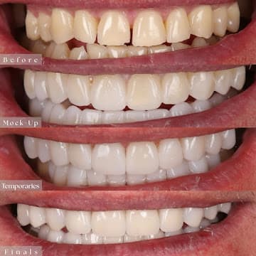 Paradise Dental Dubai gallery photo 7
