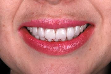 Paradise Dental Dubai gallery photo 8