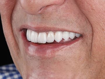 Paradise Dental Dubai gallery photo 9